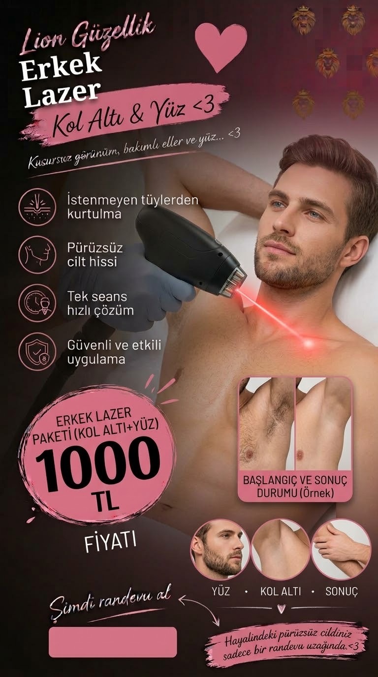 ERKEK LAZER EPİLASYON